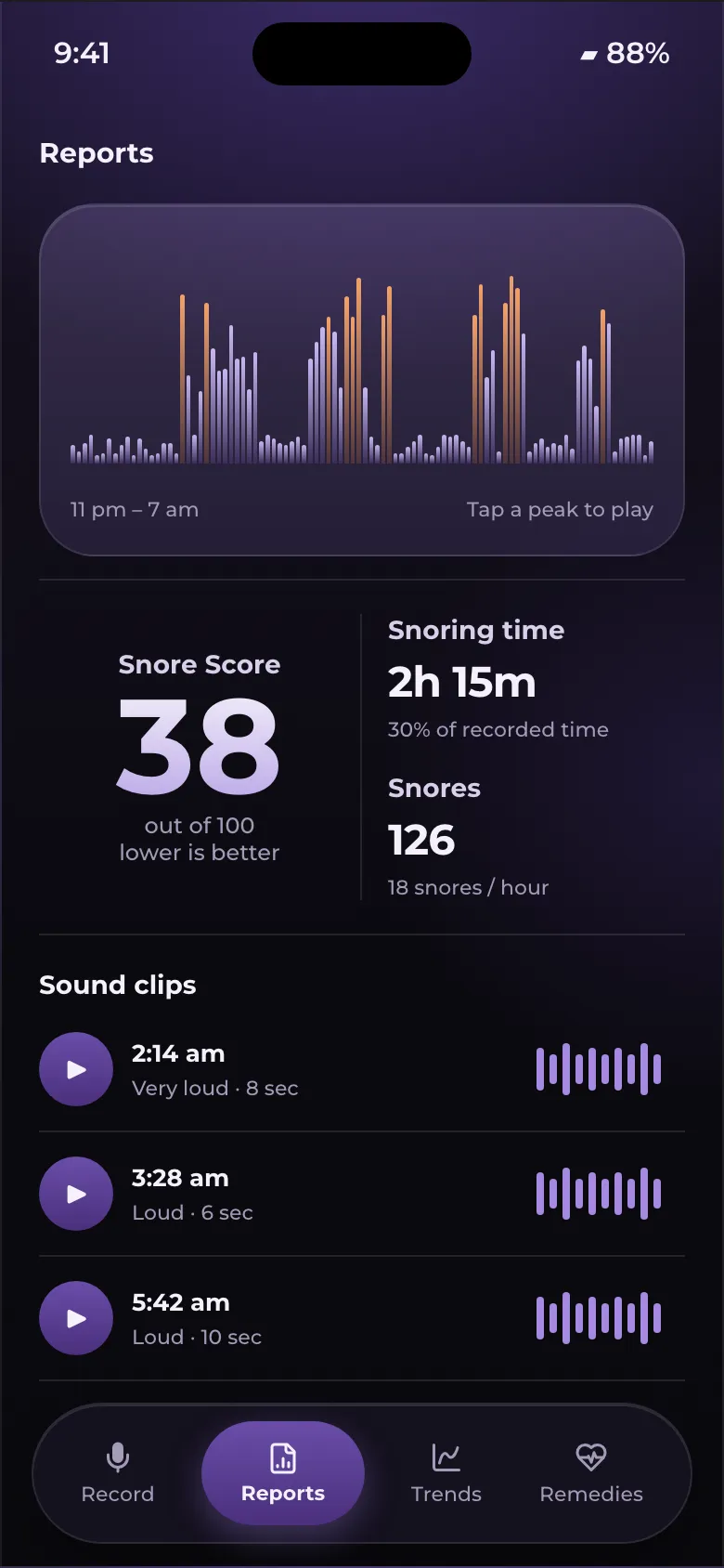 Tomorrow morning's report: the night's snoring graph, a Snore Score of 38 and the loudest snores to play back