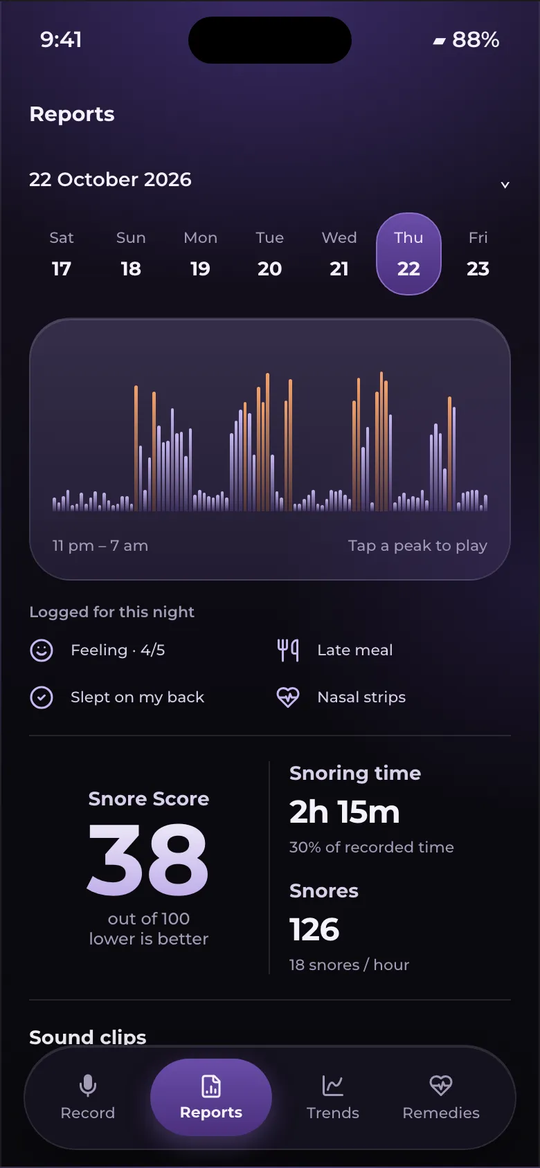snoreMIC night report: the night's snoring graph, Snore Score 38 and 2 hours 15 minutes of snoring